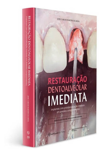 Livro Restauração Dentoalveolar Imediata Implantes Com Provisionalização Imediata Em Alvéolos Comprometidos, 2ª Edição 2023