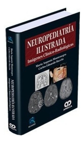 Neuropediatría Ilustrada. Imágenes Clínico-radiológicas