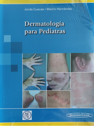 Dermatologia Pediatrica Para Pediatras 
