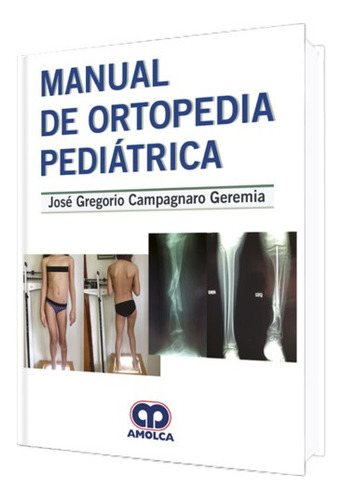 Manual De Ortopedia Pediátrica