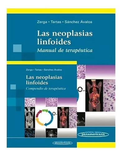 Las Neoplasias Linfoides - Zerga - Panamericana
