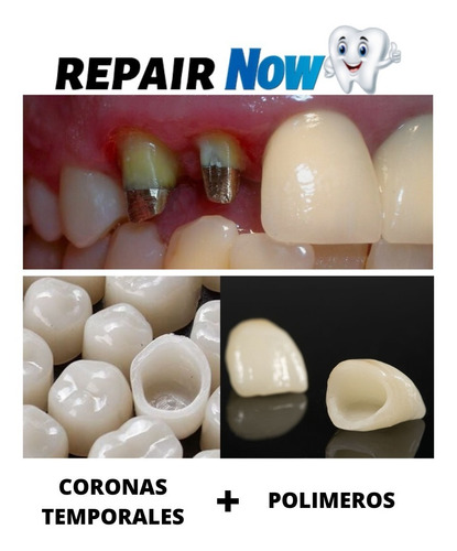Kit Dentadura Perno Corona Postiza Cosmética Agnovedades