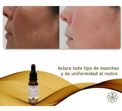 CLASS GOLD TONICO ACLARANTE FACIAL