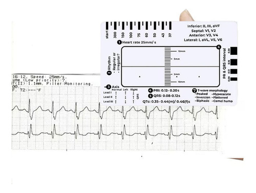 Herramienta De Medición Portátil Hp Transparent Caliper Eval
