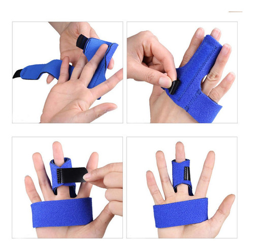 Fractura Mano Mano Derecha Izquierda Metal Azul Izquierda