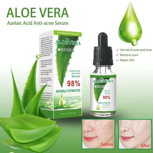 Genérica Aloe Gel Facial Removal Liquid Moisturizing Moisturizing Oil Repair Essence35ml Almohadilla - Verde - Flores