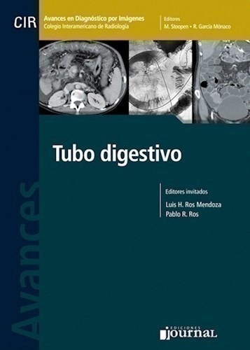 Avances En Diagnóstico Por Imágenes: Tubo Digestivo - Ros M