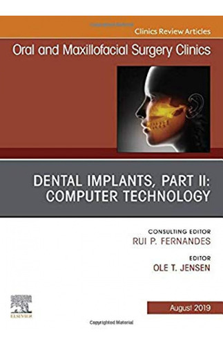 Dental Implants, Part Ii