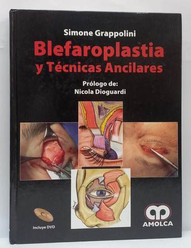 Blefaroplastia Y Tecnicas Ancilares