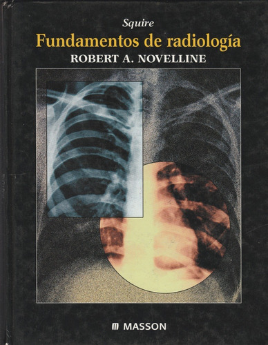 Fundamentos De Radiologia Robert A Novelline 