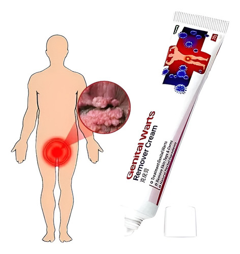 1x Pomada Tira Verruga Hpv Coceiras Manchas Fungos Neutra