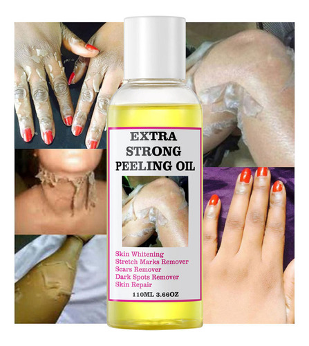 Aceite Exfoliante Amarillo Extra Fuerte En Forma De V For B