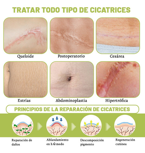2pcs Silicona Scar Sheets Parche Para Eliminación Cicatrices
