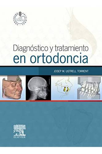 Diagnóstico Y Tratamiento En Ortodoncia. Student Consu 610d9