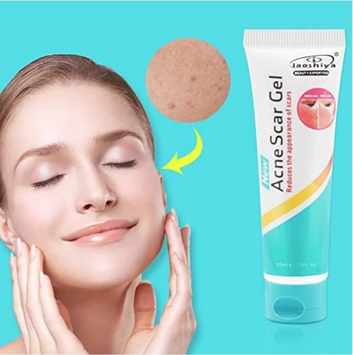Imagen 5 de 5 de Crema Gel Contra Acne,espinillas,repara, Inflamacion Facial
