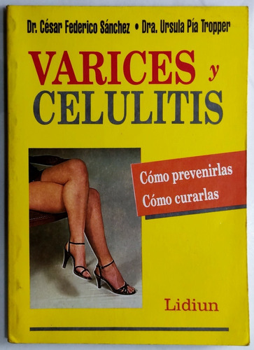 Sánchez. Várices Y Celulitis. 1992. Salud, Belleza,