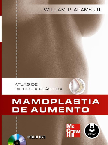 Livro Mamoplastia De Aumento: Atlas De Cirurgia Plástica