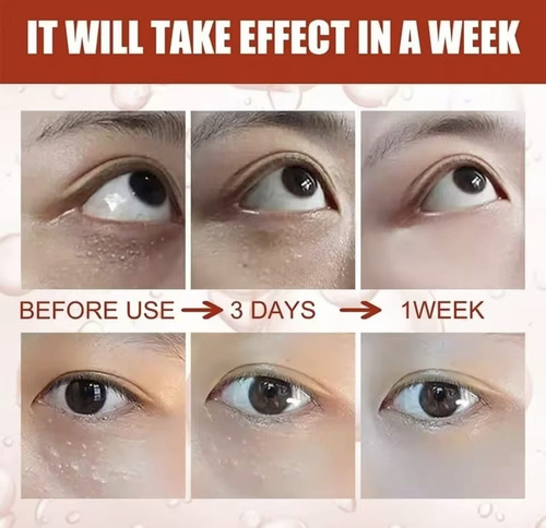 Pack 2 Crema Blanqueadora De Ojos Con Ácido Kójico, Gránulos Todo Tipo De Piel Día/noche