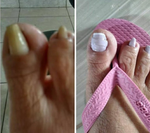 Imagem 3 de 5 de Podologia À Domicílio