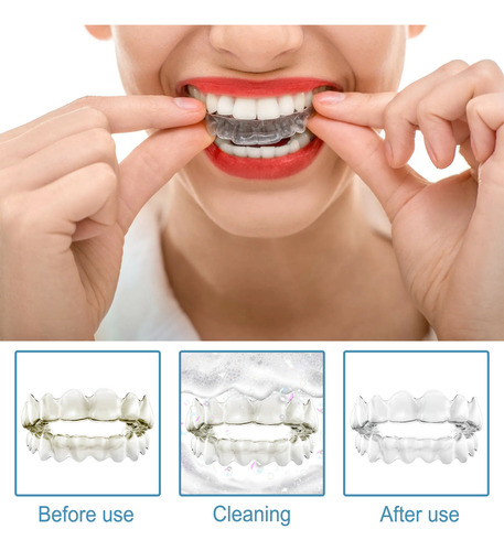 Limpiador De Espuma Q Teeth Braces Limpiador De Dientes Foam