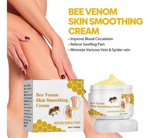 Crema Reparadora De Venas Varico Con Veneno De Abeja.1pc