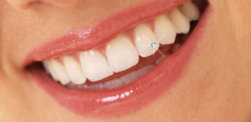 Piercing Dental Cristal Odontología 10 Unidades