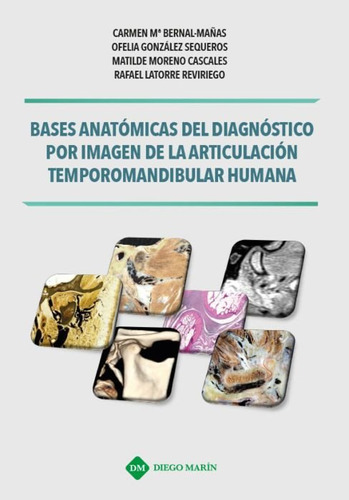 Bases Anatomicas Del Diagnostico Por Imagen De La Articul...