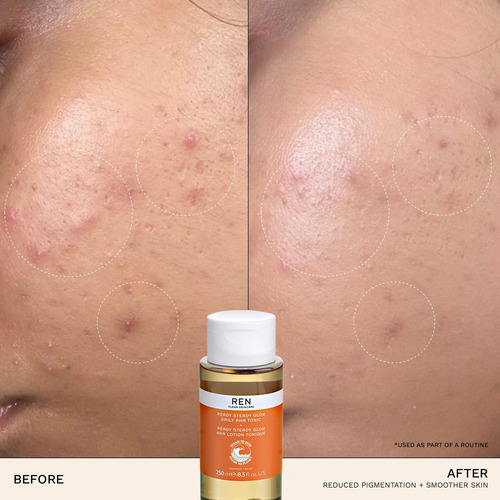 Tónico Ren Clean Skincare Ready Steady Glow 250 Ml Normal A Sensible Noche