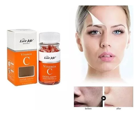 Vitamina C Para Rostro Antiarrugas, Elimina Manchas Y Ojeras