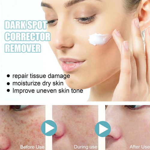 Crema Correctora E Antimanchas Para Rostro Y Cuerpo Age S