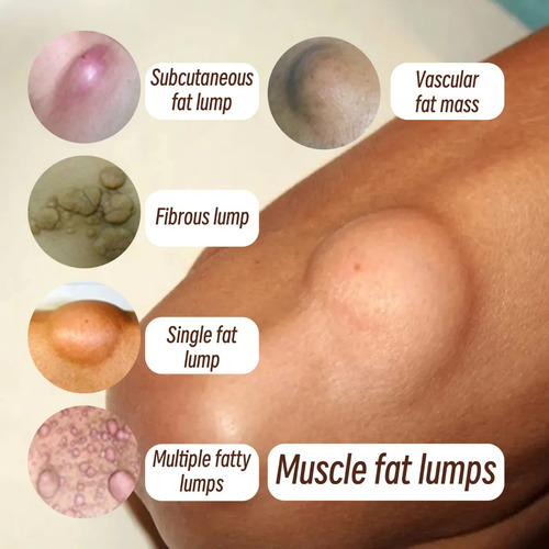 Crema De Cuidado Corporal Con Masaje Subcutáneo E Hidratante