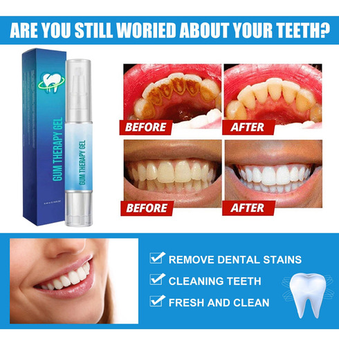 Bolígrafo Blanqueador Dental Rotativo W Tooth Whitening T 10