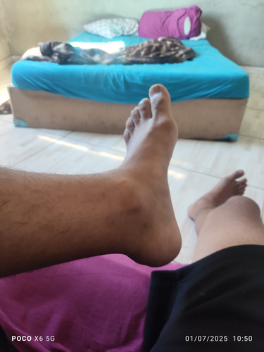 Foto Do Pé Victor