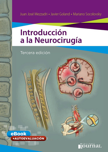 Introduccion A La Neurocirugia - Mezzadri, Juan Jose