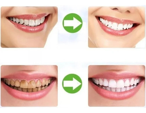3. Creme Dental De Carvão De Bambu Remove O Tártaro