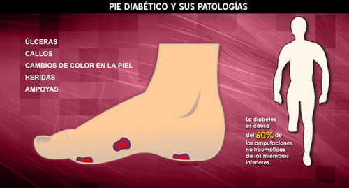Plantillas Ortopédicas Para Cuidado Pie Diabético Ajustables
