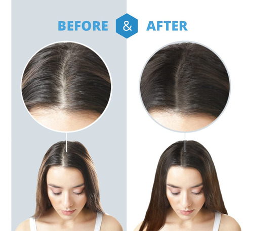Champú Dermachange Hair Growth Para Cabello Fino 480 Ml