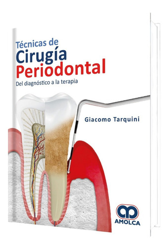 Técnicas De Cirugía Periodontal Diagnóstico Terapia Tarquini