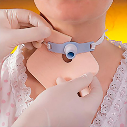 Espuma para Traqueostomia Smith+Nephew Smith E Nephew Traqueostomia x Unidade