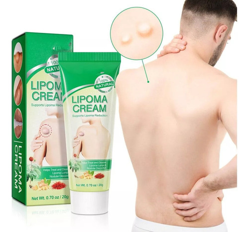 Pomada Cremosa Eliminadora De Lipomas Para Tratamento