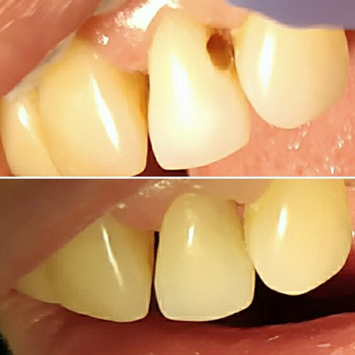 Imagen 8 de 10 de Consultorio Odontológico/ Dentista/ Prótesis Dentales
