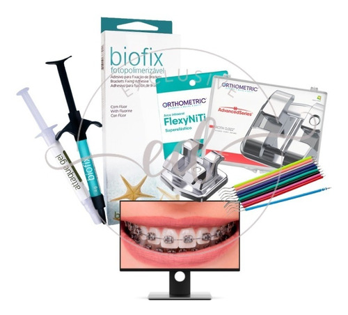 Kit Aparelho Dental - Braquete, Cola, Fio, Borrachinha Ofert