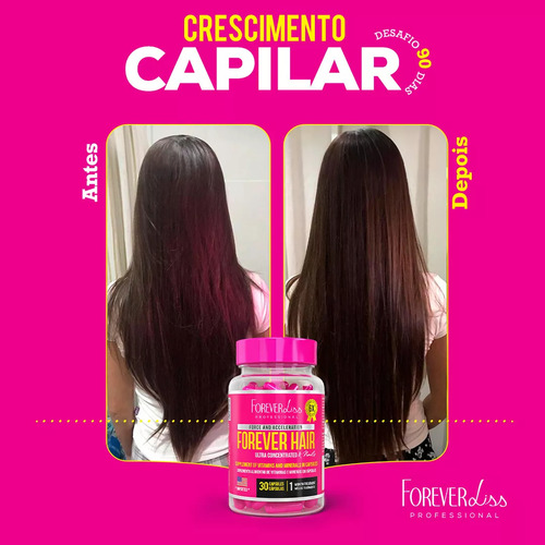 Forever Hair Forever Liss Crescimento Capilar 30 Dias