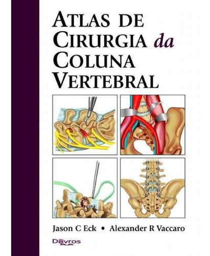 Livros: Atlas De Cirurgia Da Coluna Vertebral