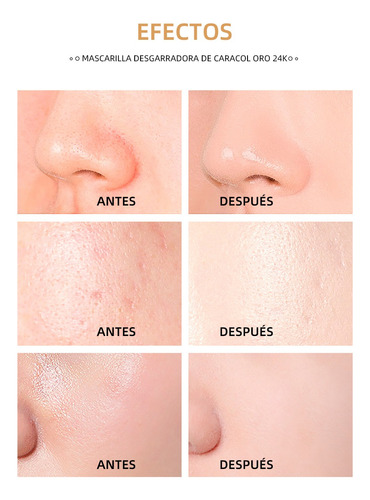 Ml Mascarilla Despegable Con Lámina Dorada