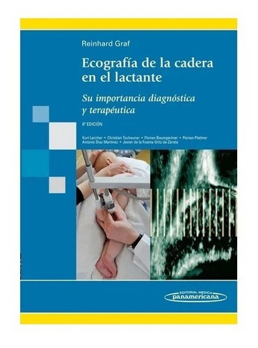 Ecografia De La Cadera En El Lactante Nuevo