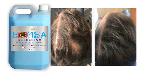 Bidon Bomba De Biotina Bellamax Mascara Capilar 5kg