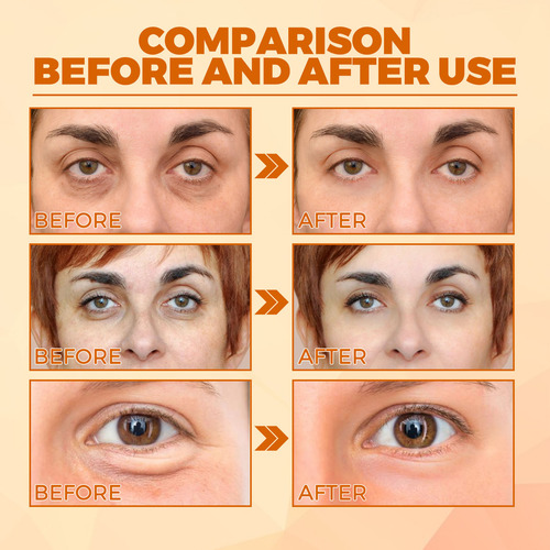 Ae Crema For Ojos Con Polipéptidos De Miel Crema For Ojos