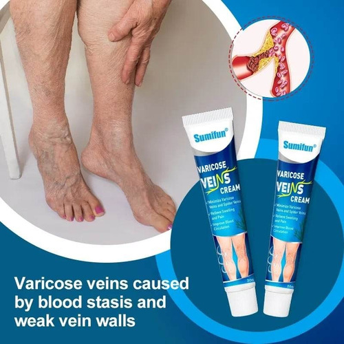 Crema Quita Varices Super Efectiva Desinflama Alivia Hierbas