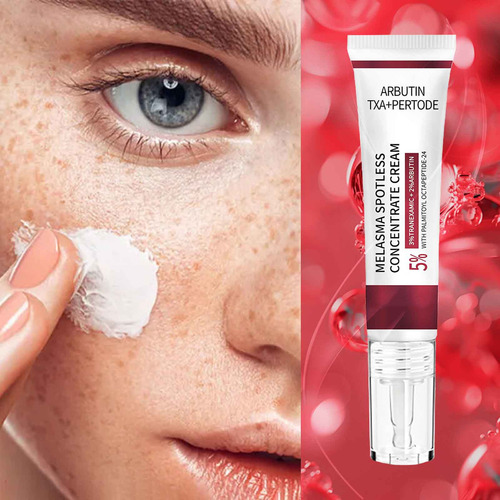 Crema Concentrada Impecable Para Melasma De D Arbutins: Cuid
